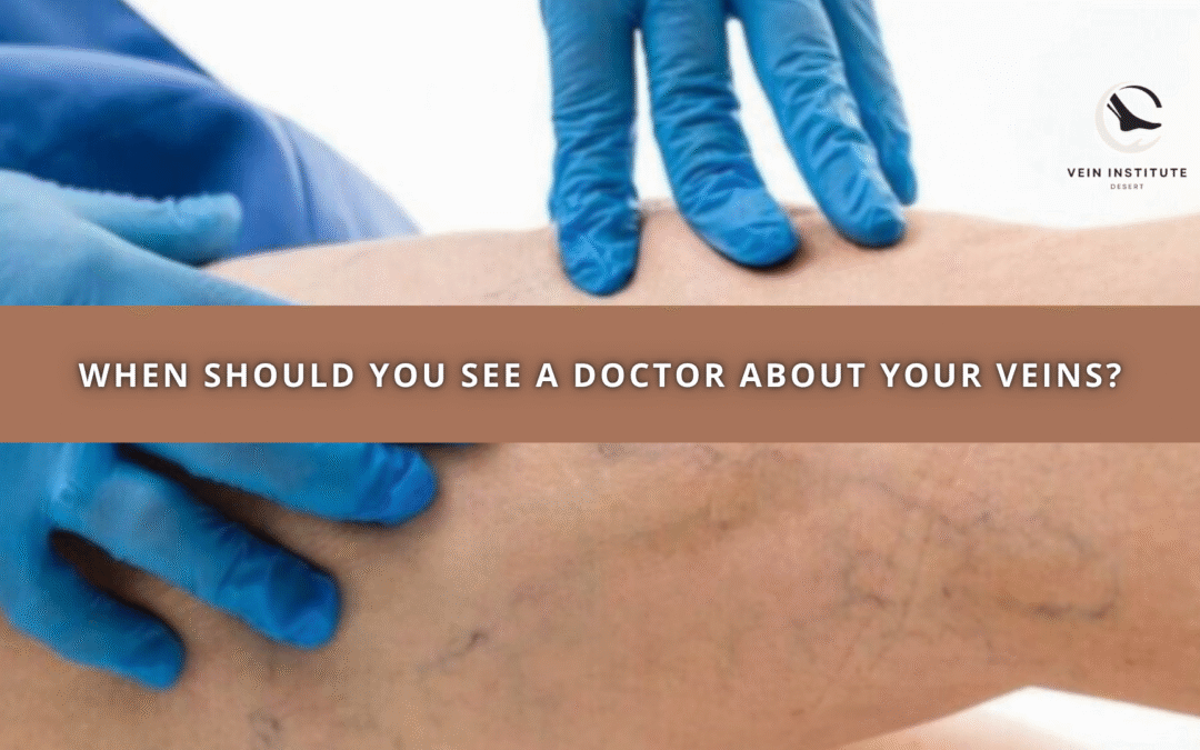 When Should You See a Doctor About Your Veins?