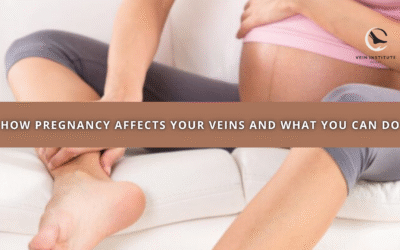 How Pregnancy Affects Your Veins and What You Can Do