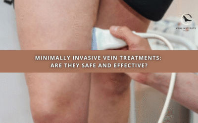Minimally Invasive Vein Treatments: Are They Safe and Effective?