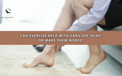 Can Exercise Help With Varicose Veins or Make Them Worse?