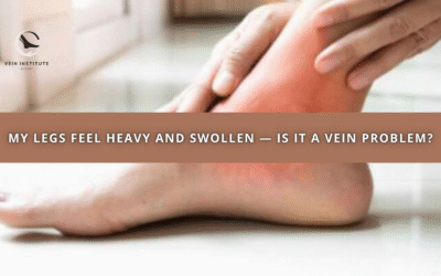 My Legs Feel Heavy and Swollen — Is It a Vein Problem?