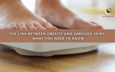 The Link Between Obesity and Varicose Veins: What You Need to Know