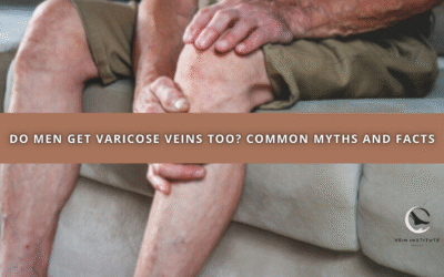 Do Men Get Varicose Veins Too? Common Myths and Facts