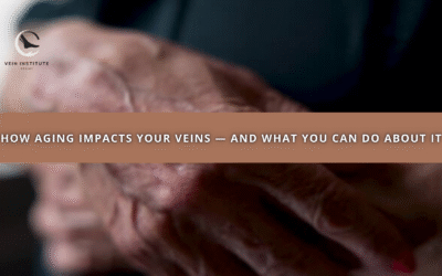 How Aging Impacts Your Veins — And What You Can Do About It