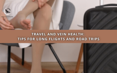 Travel and Vein Health: Tips for Long Flights and Road Trips