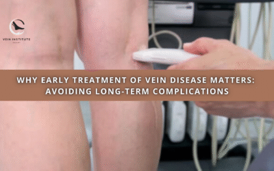 Why Early Treatment of Vein Disease Matters: Avoiding Long-Term Complications