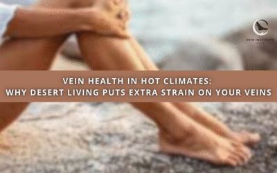 Vein Health in Hot Climates: Why Desert Living Puts Extra Strain on Your Veins