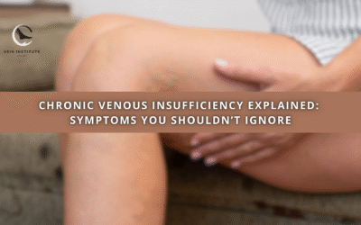 Chronic Venous Insufficiency Explained: Symptoms You Shouldn’t Ignore