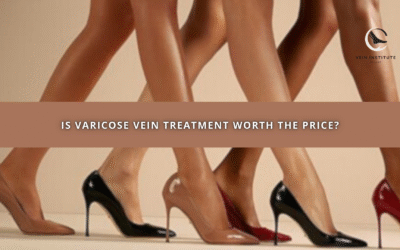Is Varicose Vein Treatment Worth the Price? Expert Insights from Palm Desert