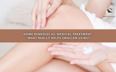 Home Remedies vs. Medical Treatment: What Really Helps Swollen Veins?