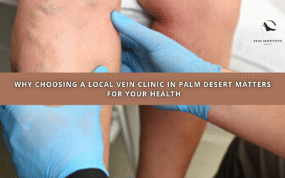 Why Choosing a Local Vein Clinic in Palm Desert Matters for Your Health