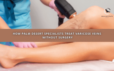 How Palm Desert Specialists Treat Varicose Veins Without Surgery