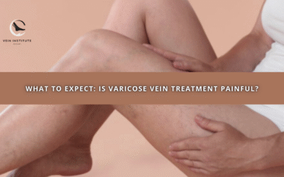What to Expect: Is Varicose Vein Treatment Painful?