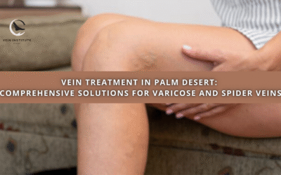 Vein Treatment in Palm Desert: Comprehensive Solutions for Varicose and Spider Veins