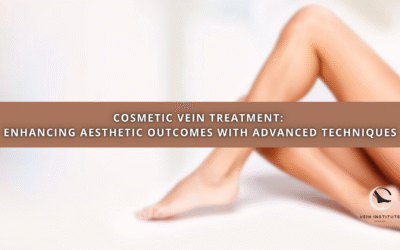 Cosmetic Vein Treatment: Enhancing Aesthetic Outcomes with Advanced Techniques