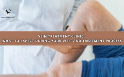 Vein Treatment Clinic: What to Expect During Your Visit and Treatment Process
