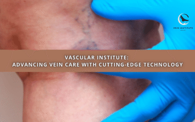 Vascular Institute: Advancing Vein Care with Cutting-Edge Technology