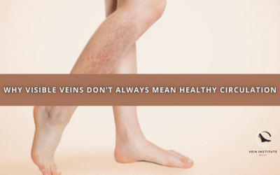 Why Visible Veins Don’t Always Mean Healthy Circulation