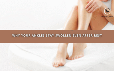 Why Your Ankles Stay Swollen Even After Rest