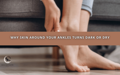 Why Skin Around Your Ankles Turns Dark or Dry