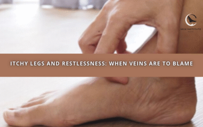 Itchy Legs and Restlessness: When Veins Are to Blame