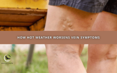 How Hot Weather Worsens Vein Symptoms