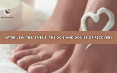 After Vein Treatment: The Do’s and Don’ts of Recovery