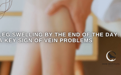 Leg Swelling by the End of the Day: A Key Sign of Vein Problems