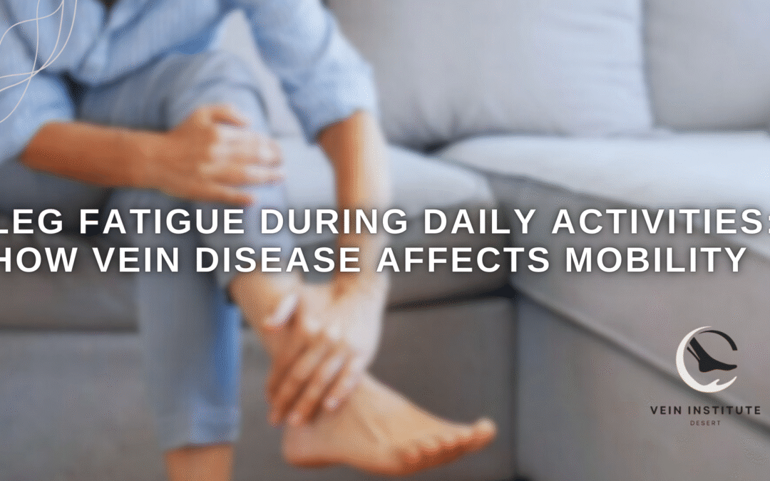 Leg Fatigue During Daily Activities: How Vein Disease Affects Mobility