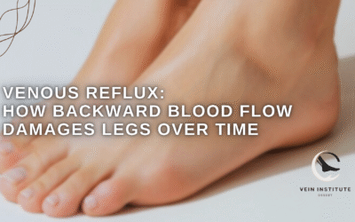 Venous Reflux: How Backward Blood Flow Damages Legs Over Time