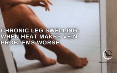 Chronic Leg Swelling: When Heat Makes Vein Problems Worse