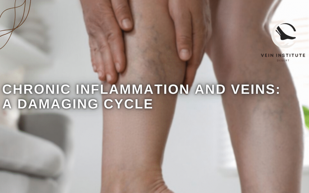 Chronic Inflammation and Veins: A Damaging Cycle