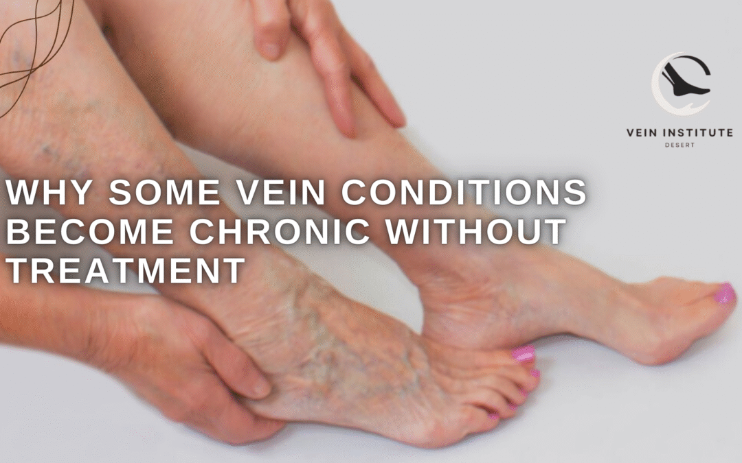 Why Some Vein Conditions Become Chronic Without Treatment