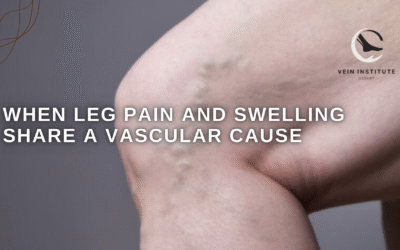 When Leg Pain and Swelling Share a Vascular Cause