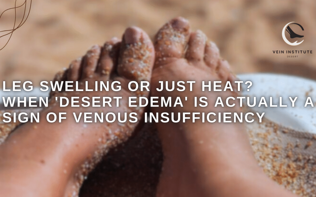 Leg Swelling or Just Heat? When ‘Desert Edema’ is Actually a Sign of Venous Insufficiency.