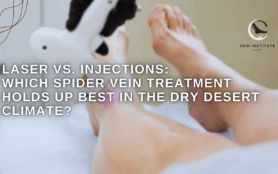 Laser vs. Injections: Which Spider Vein Treatment Holds Up Best in the Dry Desert Climate?