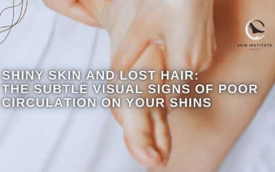 Shiny Skin and Lost Hair: The Subtle Visual Signs of Poor Circulation on Your Shins.