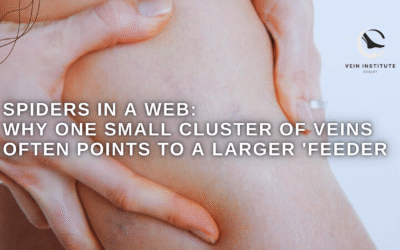 Spiders in a Web: Why One Small Cluster of Veins Often Points to a Larger ‘Feeder