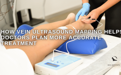 How Vein Ultrasound Mapping Helps Doctors Plan More Accurate Treatment