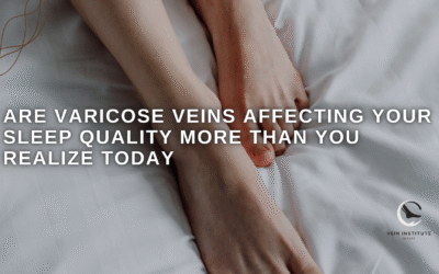 Are Varicose Veins Affecting Your Sleep Quality More Than You Realize Today